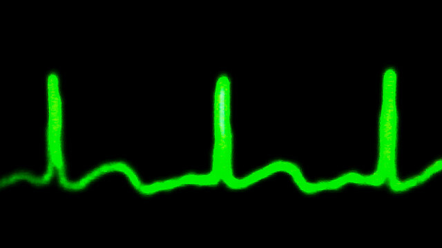 hartslag-puls